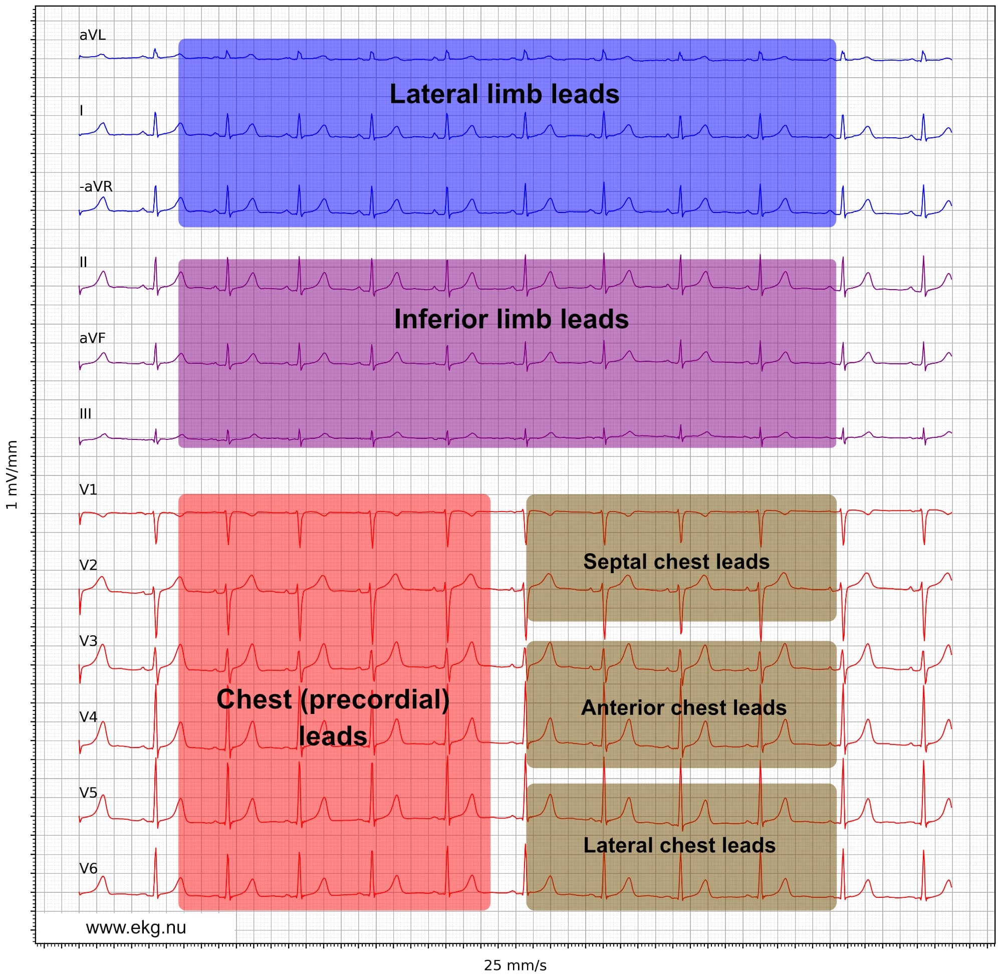 12 lead ecg leads limb chest cabrera format paper