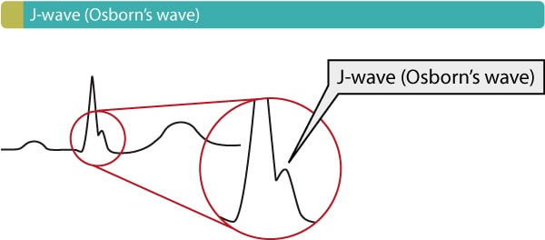 Figure 14. Osborn
