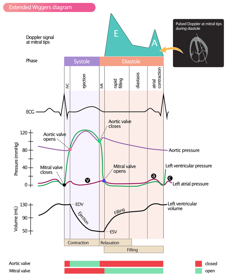 Figure 2. Wiggers diagram showing pressure, volume, Doppler signal, ECG and AV valves during the cardiac cycle. Doppler recording of mitral valve flow during diastole. (a) = active atrial filling; (b) = increased atrial pressure due to bulging of mitral valve into the left atrium, when valve closes; (c) = passive atrial filling.