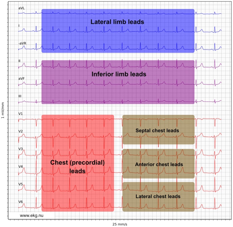 Figure 21. Presentation of the ECG leads according to the Cabrera format and aVR inverted to –aVR.