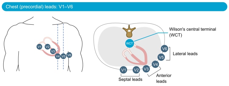 Figure 19. The chest (precordial) leads. WCT = Wilson