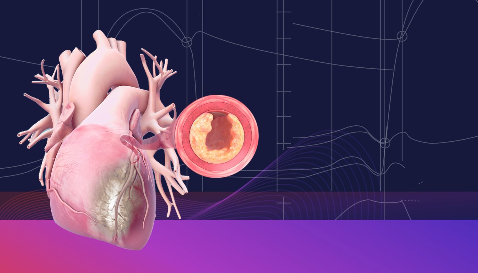 Illustration ur kursen Cardiovascular Medicine