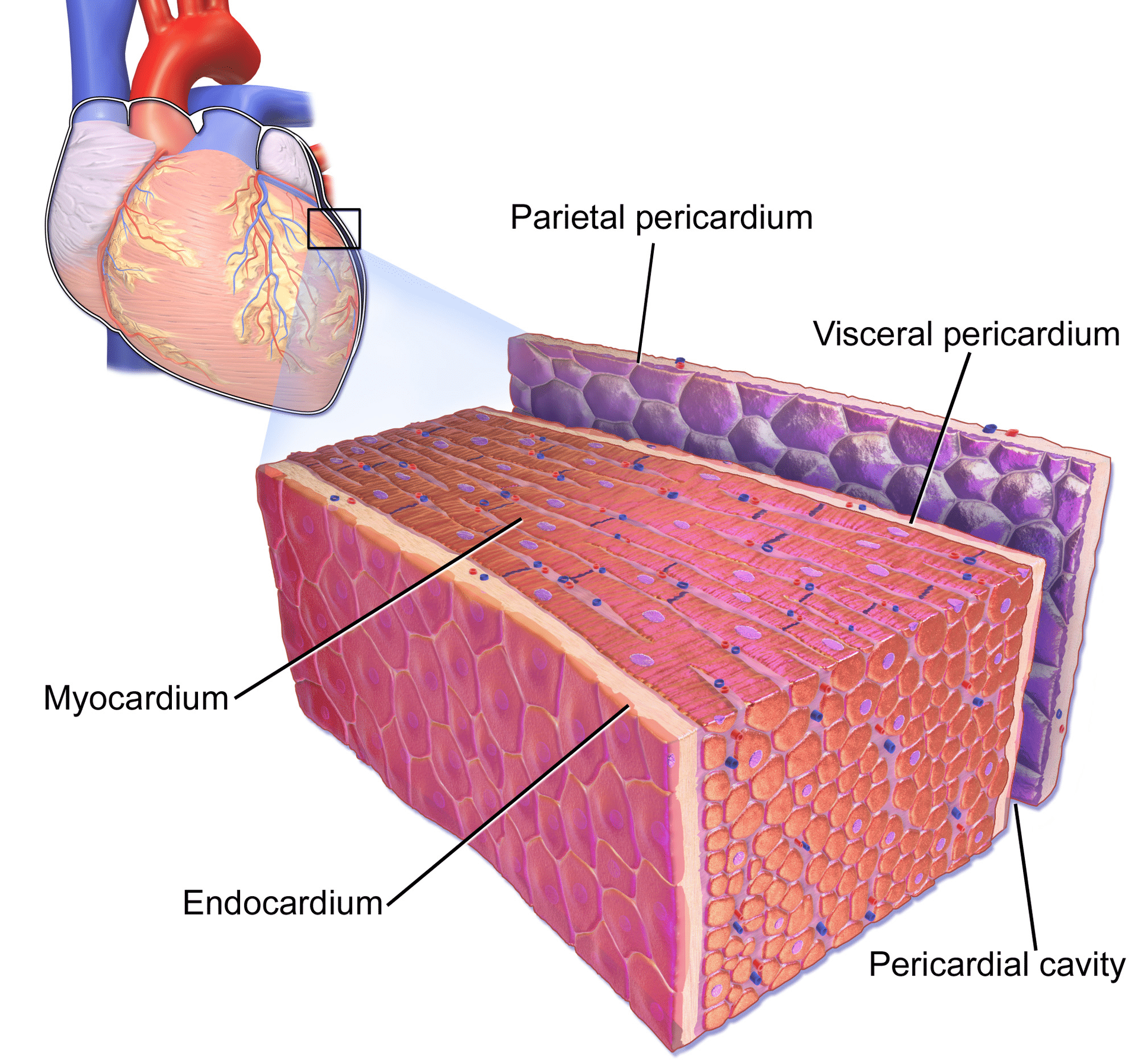 Figure 1. The pericardial sac and the myocardium. Note that pericarditis (inflammation of the pericardial sac) is difficult to discern from myocarditis (inflammation of the myocardial tissue) and because they tend to accompany each other, the term perimyocarditis is often used. Image by Bruce Blausen, Blausen Gallery 2014.