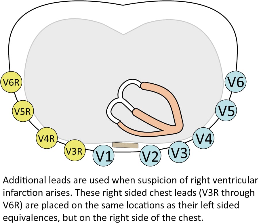 The ECG leads electrodes, limb leads, chest (precordial) leads, 12Lead ECG (EKG) ECG learning