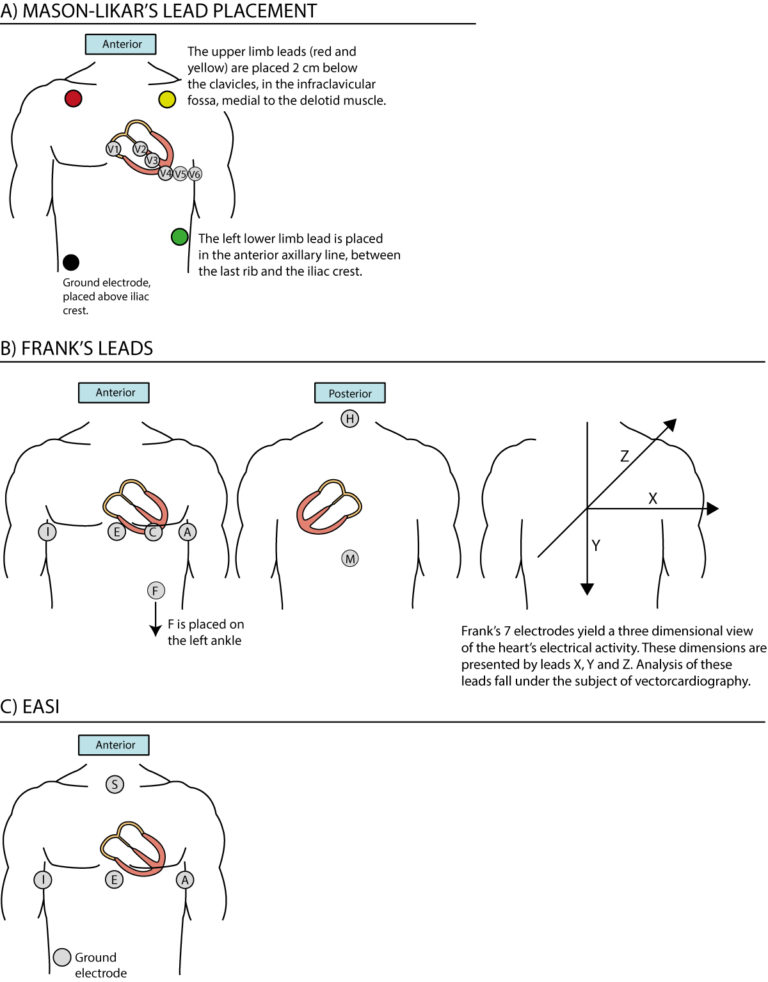 The ECG leads electrodes, limb leads, chest (precordial) leads, 12
