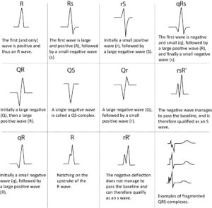 ECG interpretation: Characteristics of the normal ECG (P-wave, QRS ...