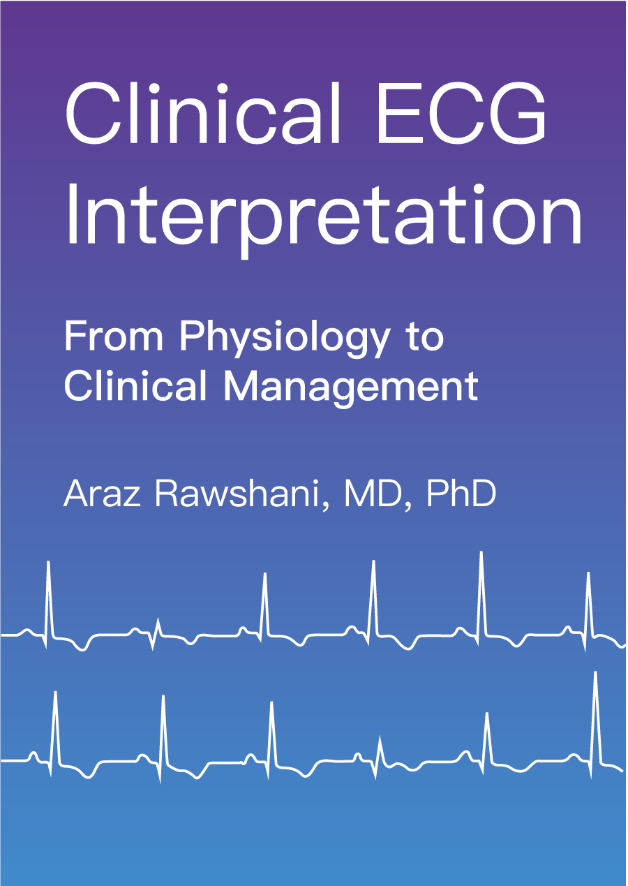 ECG book and course: learn ECG interpretation with video lectures and ...