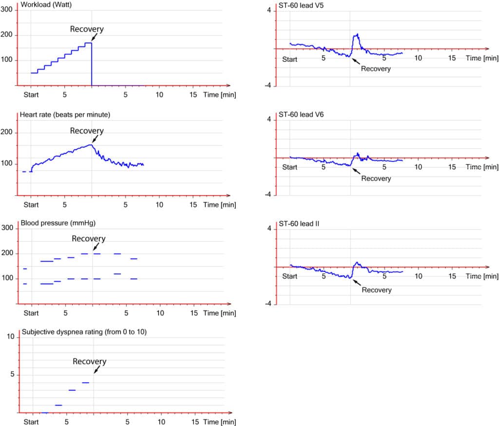 Figure 6. Overview of test results. 58 year old male with left main disease.