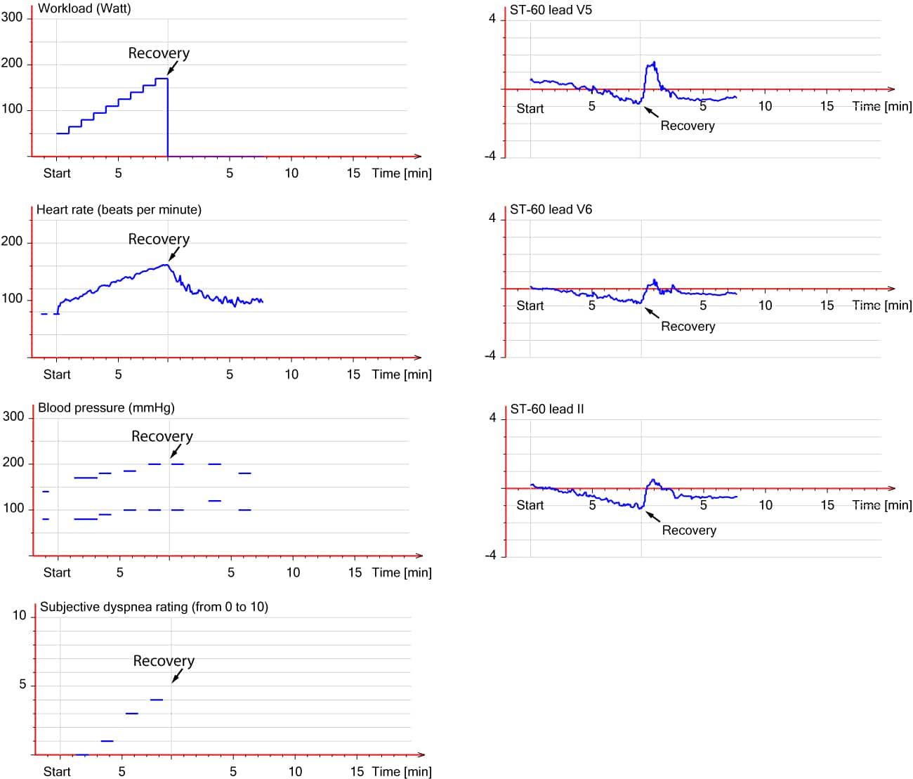 Evaluation of exercise stress test: ECG, symptoms, blood pressure, heart  rate, performance – ECG & ECHO