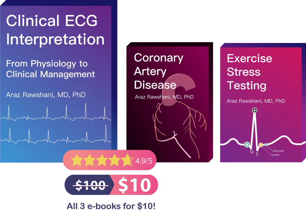 Choosing The Best Ecg Book Ecg Made Easy Or Completely Ecg Echo