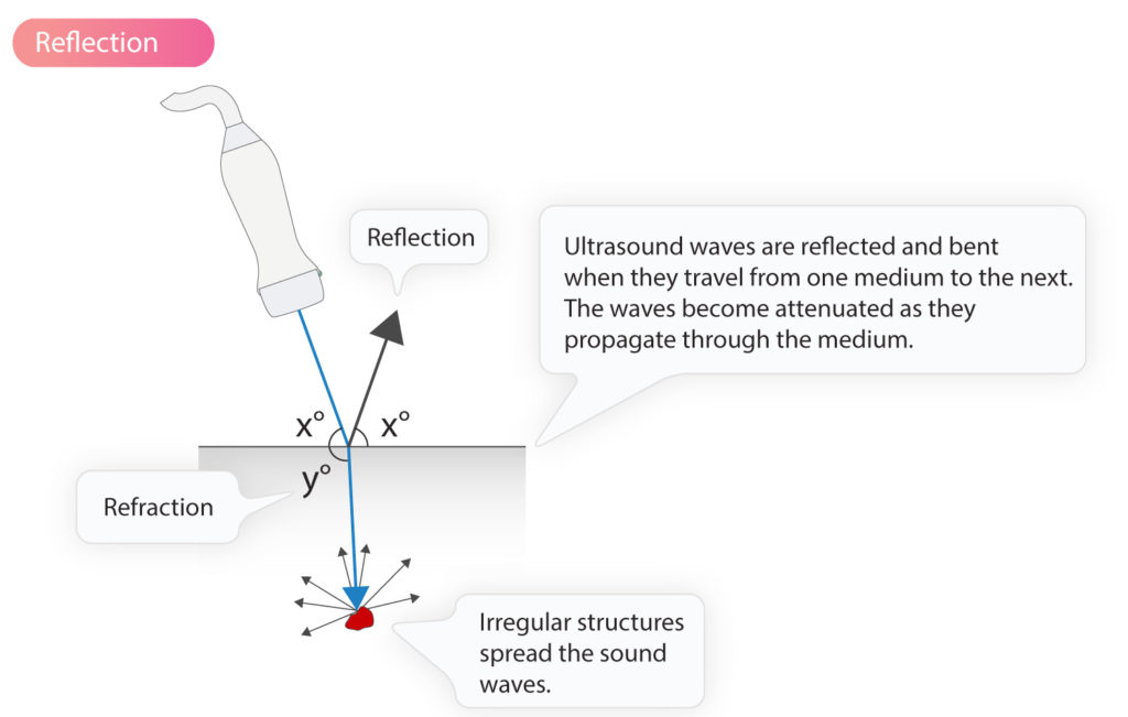 specular reflection ultrasound