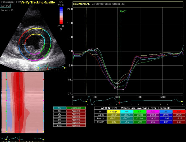 lv strain echo