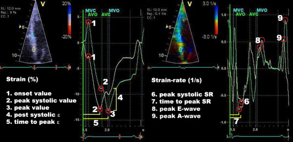 Strain Echocardiography part II: General concept 