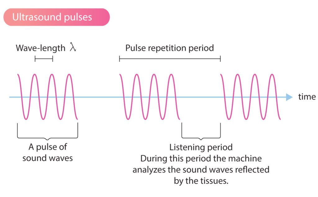 ultrasonic waves