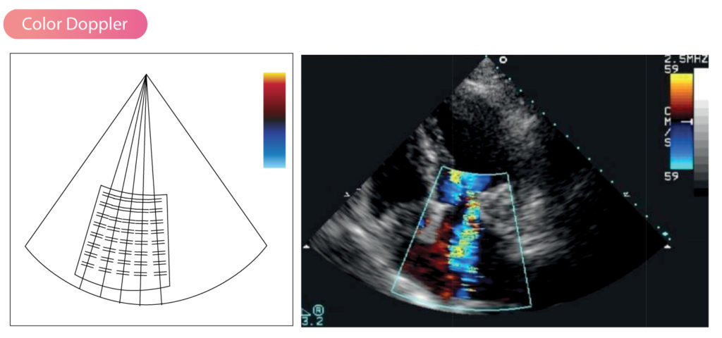 heart doppler ultrasound