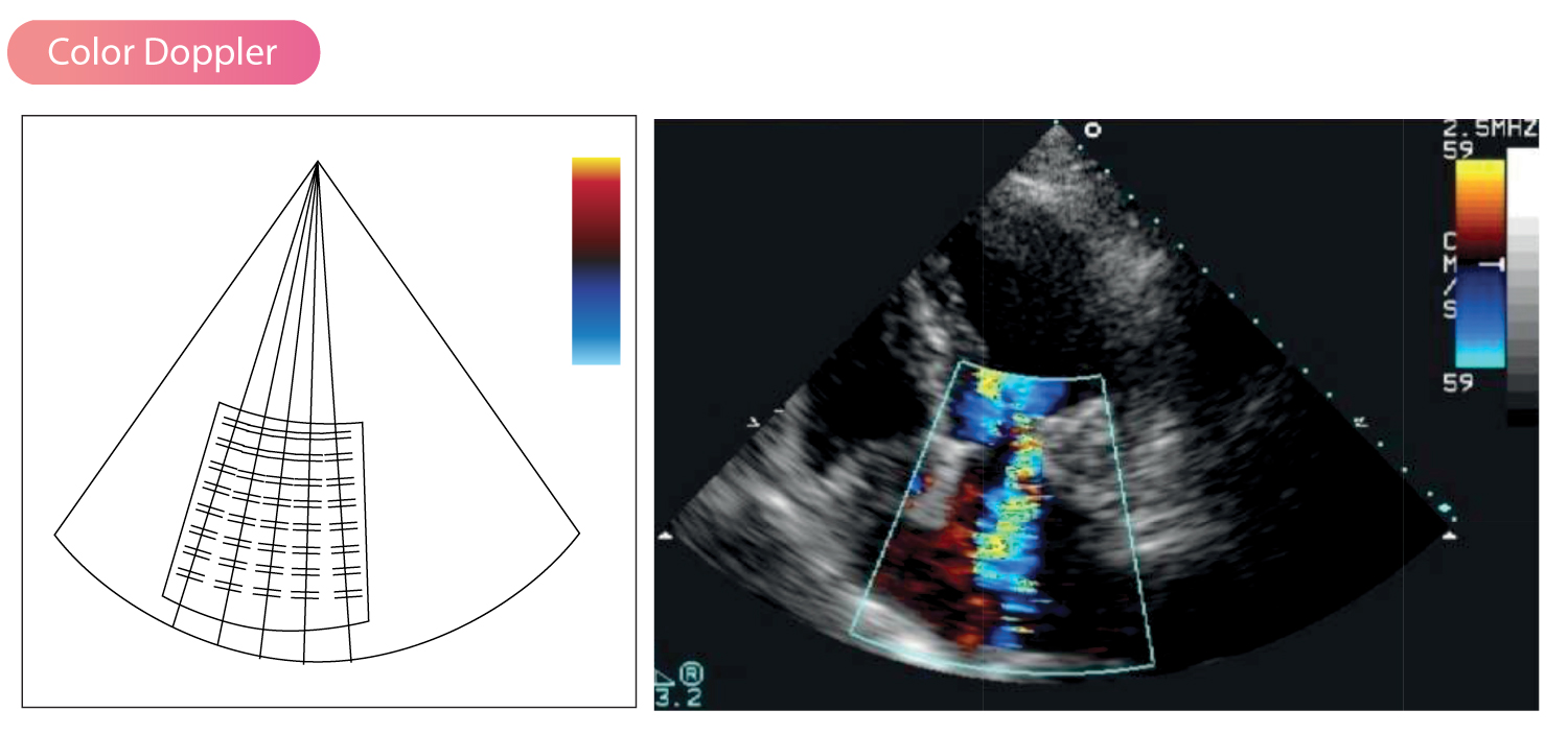 Color Doppler Ecg Echo