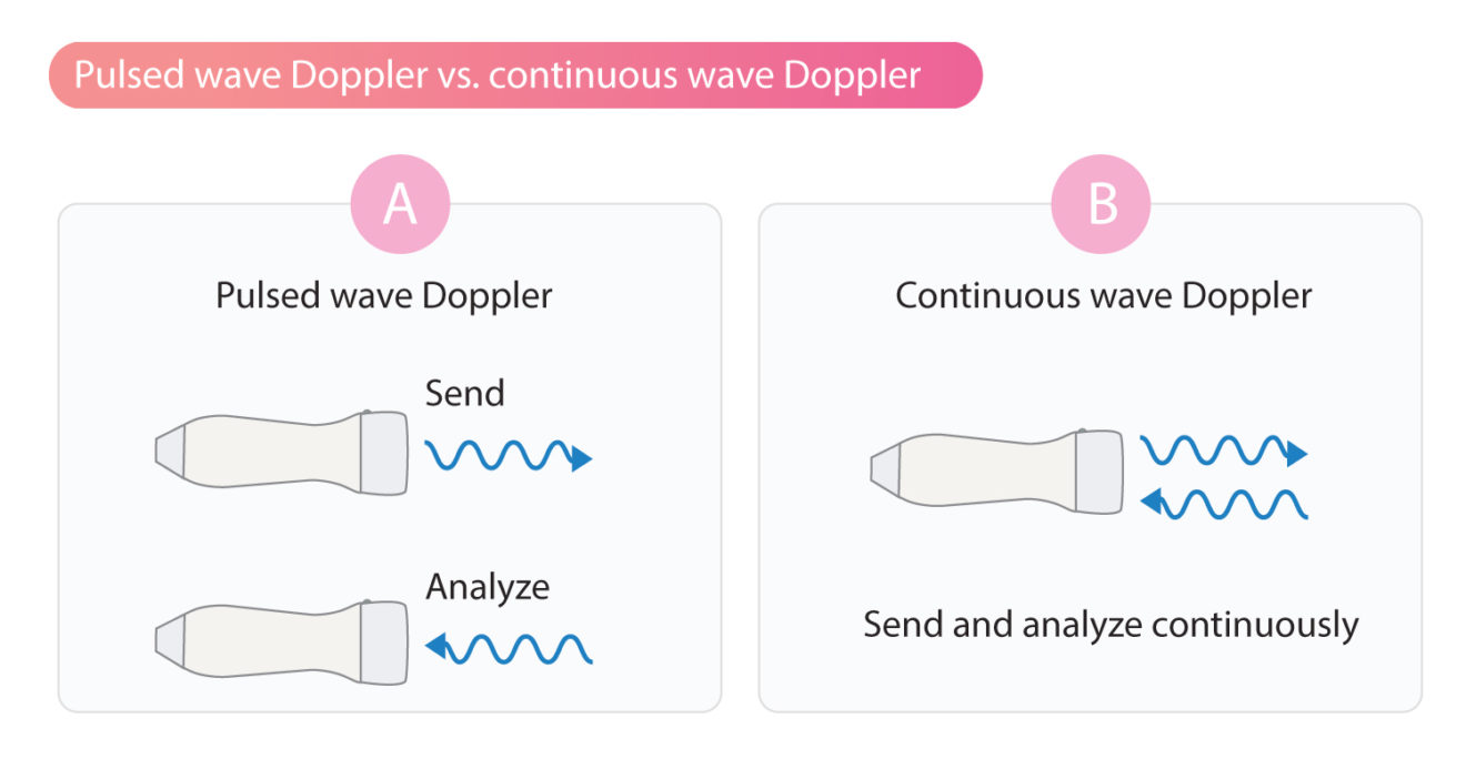 Continuous wave doppler cw doppler the cardiovascular