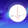 Clinical ECG Interpretation