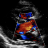 Clinical Echocardiography