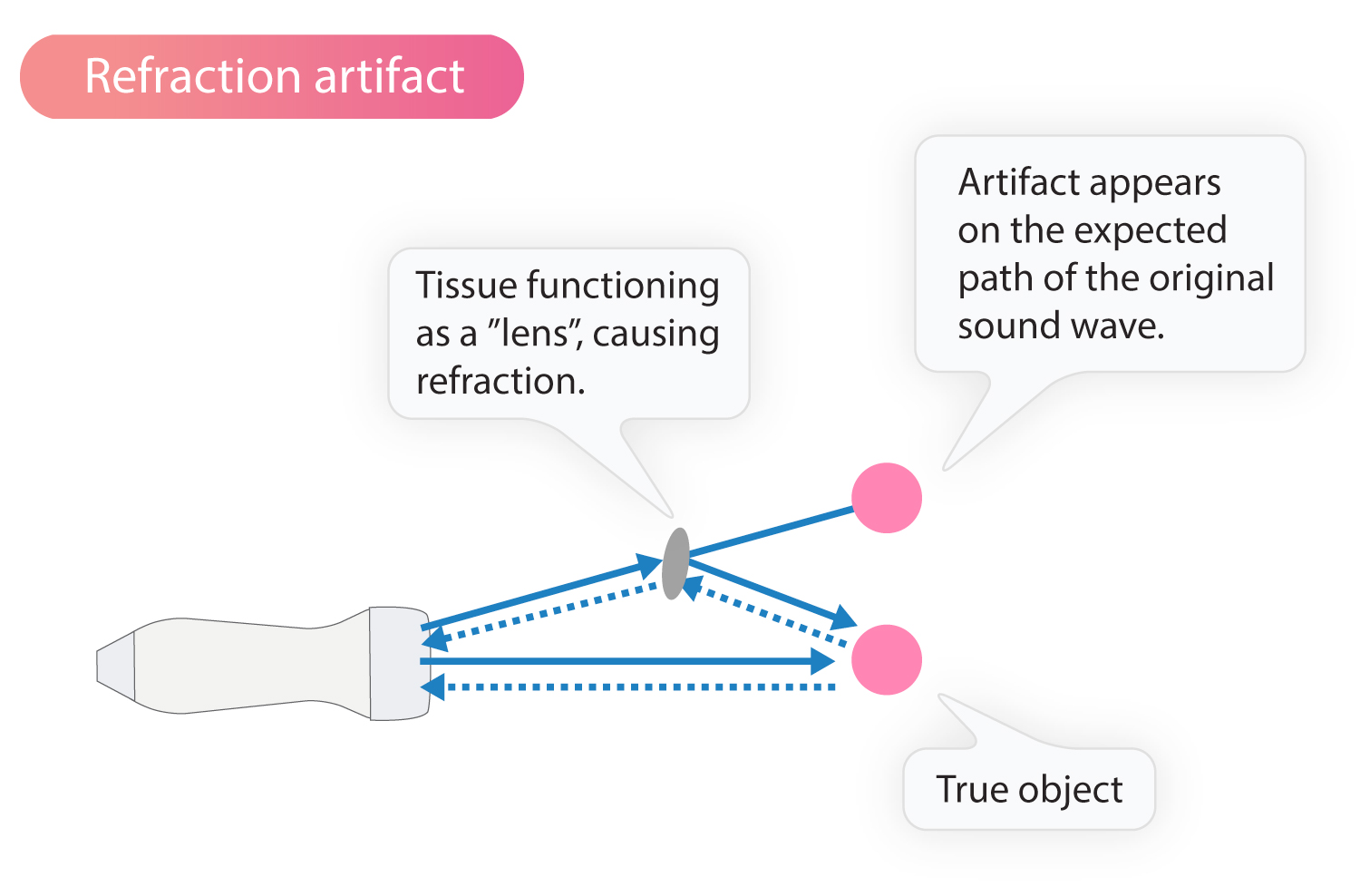 Artifacts in ultrasound imaging Cardiovascular Education