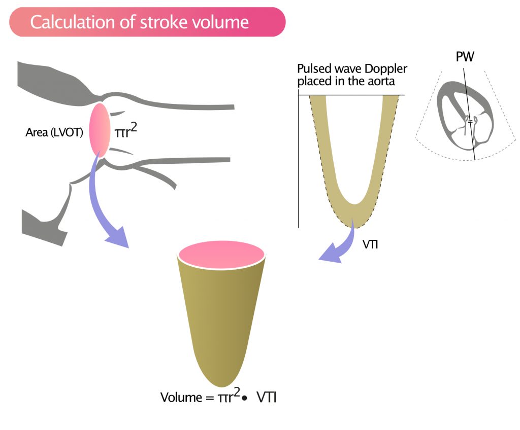 Global longitudinal strain: A new gold standard for assessing