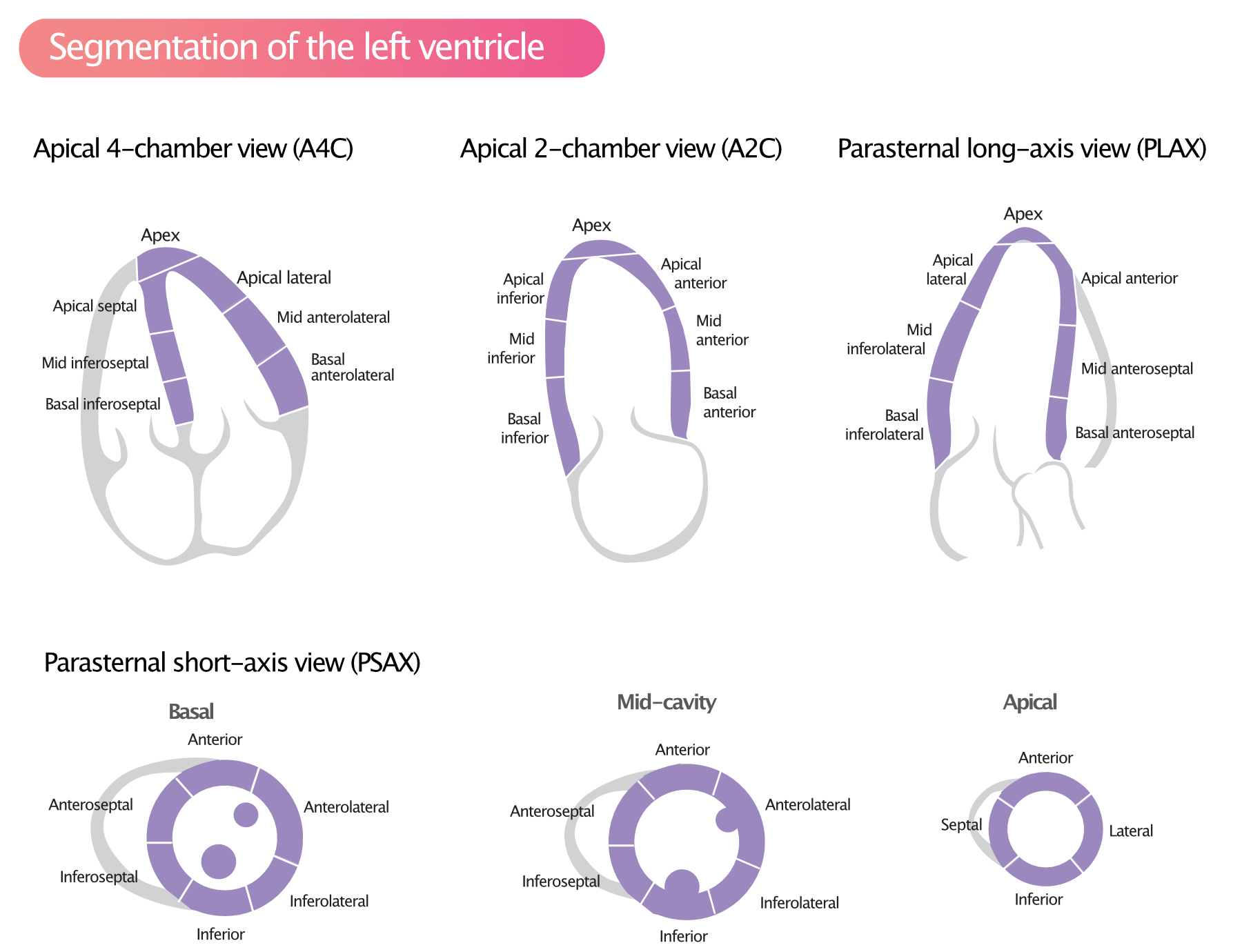 Abnormal Echocardiogram