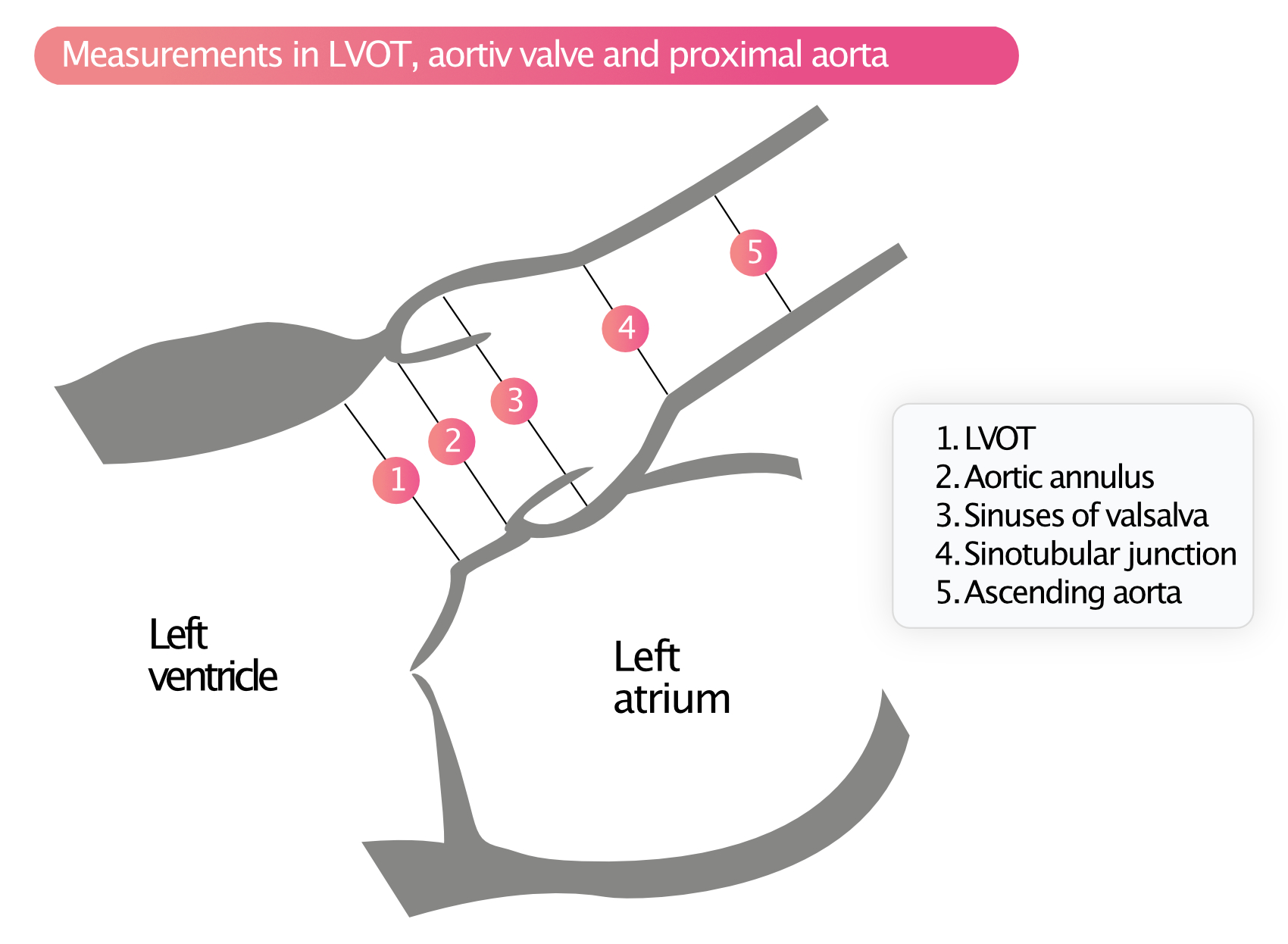 Aortic Stenosis Echocardiography Diagnosis Grading Causes Management