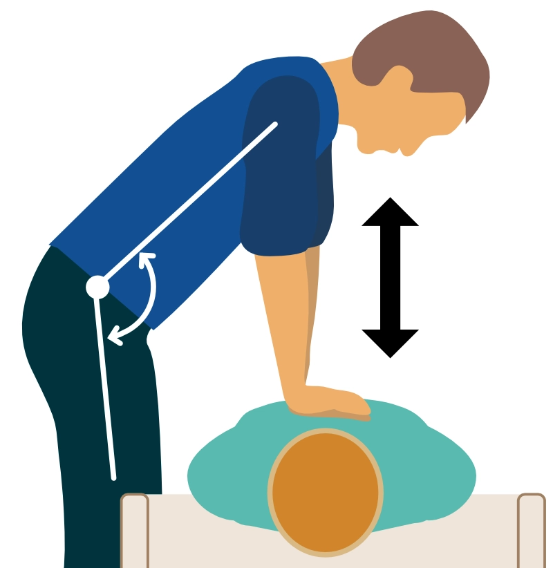 Figure 2. Manual chest compressions in ACLS.