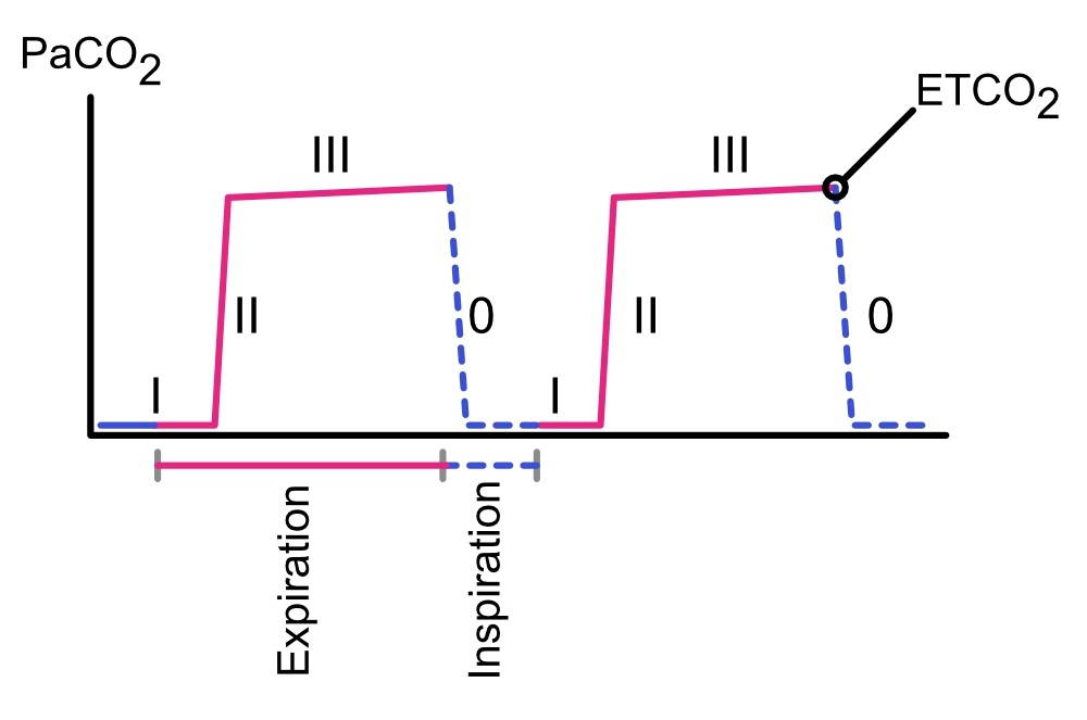 Capnography (endtidal carbon dioxide measurement, ETCO2) during