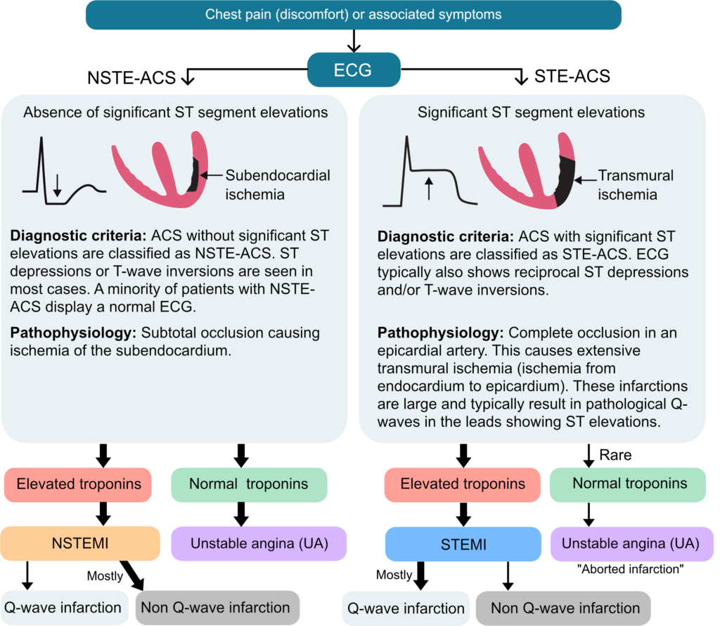 Figure 3. Traditional classification of acute coronary syndromes.